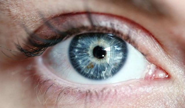 Avrupa'da Miyoplu Kişi Sayısında Patlama Yaşandı İşte Sebebi