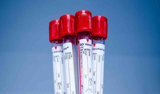 Bilim İnsanları Yeni Bir Kan Grubu Buldu