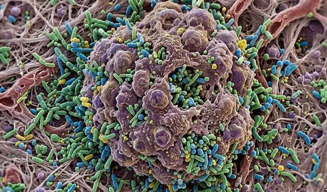 Kanser Araştırmalarında Yeni Aşama Bakteriye Tümörü Yedirmek